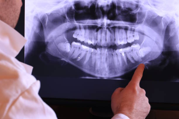 Best Emergency Dental Filling Replacement  in Kerhonkson, NY