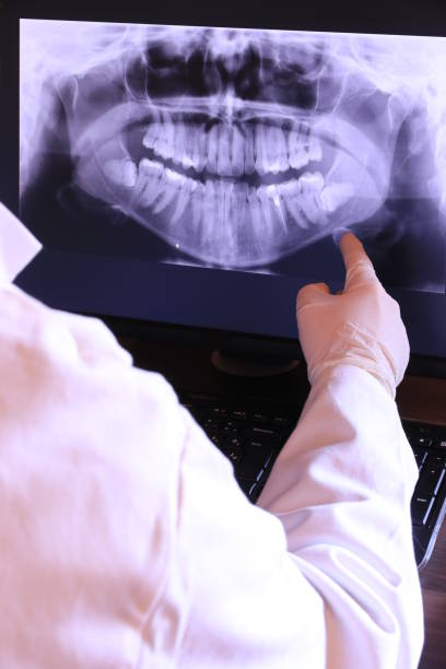 Best Knocked-Out Tooth Emergency  in Kerhonkson, NY